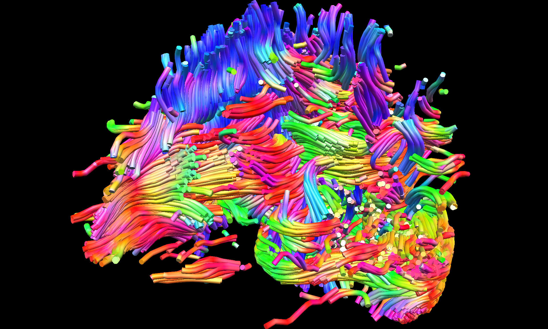 Lorin Strohm  (Fluid boundaries of perception - Lecture by Dr. Saskia Steinmann, Harvard Medical School 0)