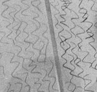 Antiknow Performance #4: